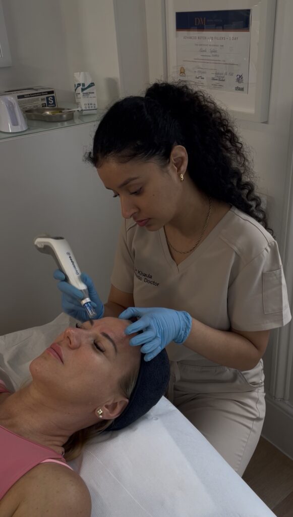 microneedling in london